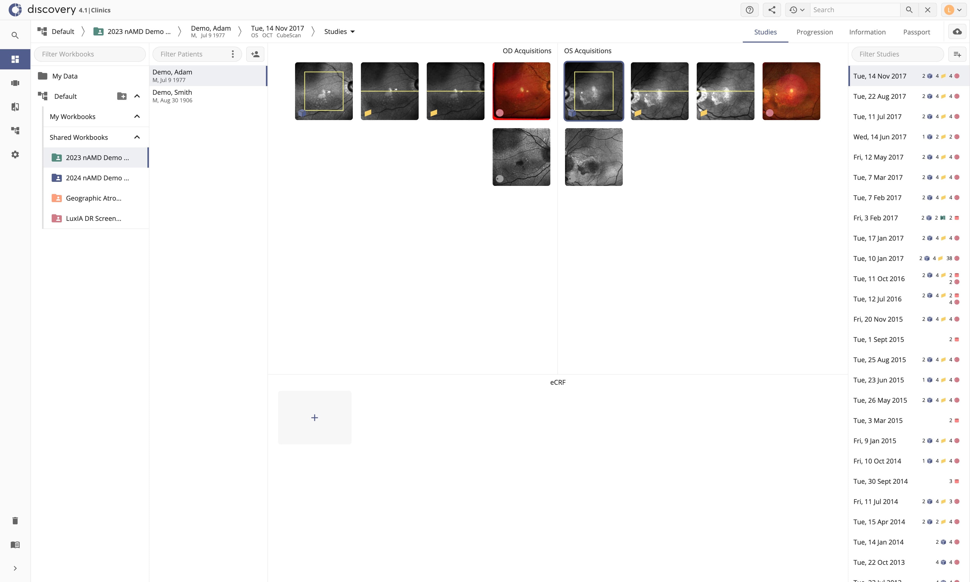 Blurred step underneath chapter